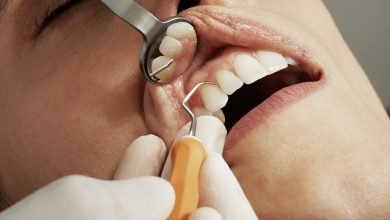 نزيف الأسنان والصيام